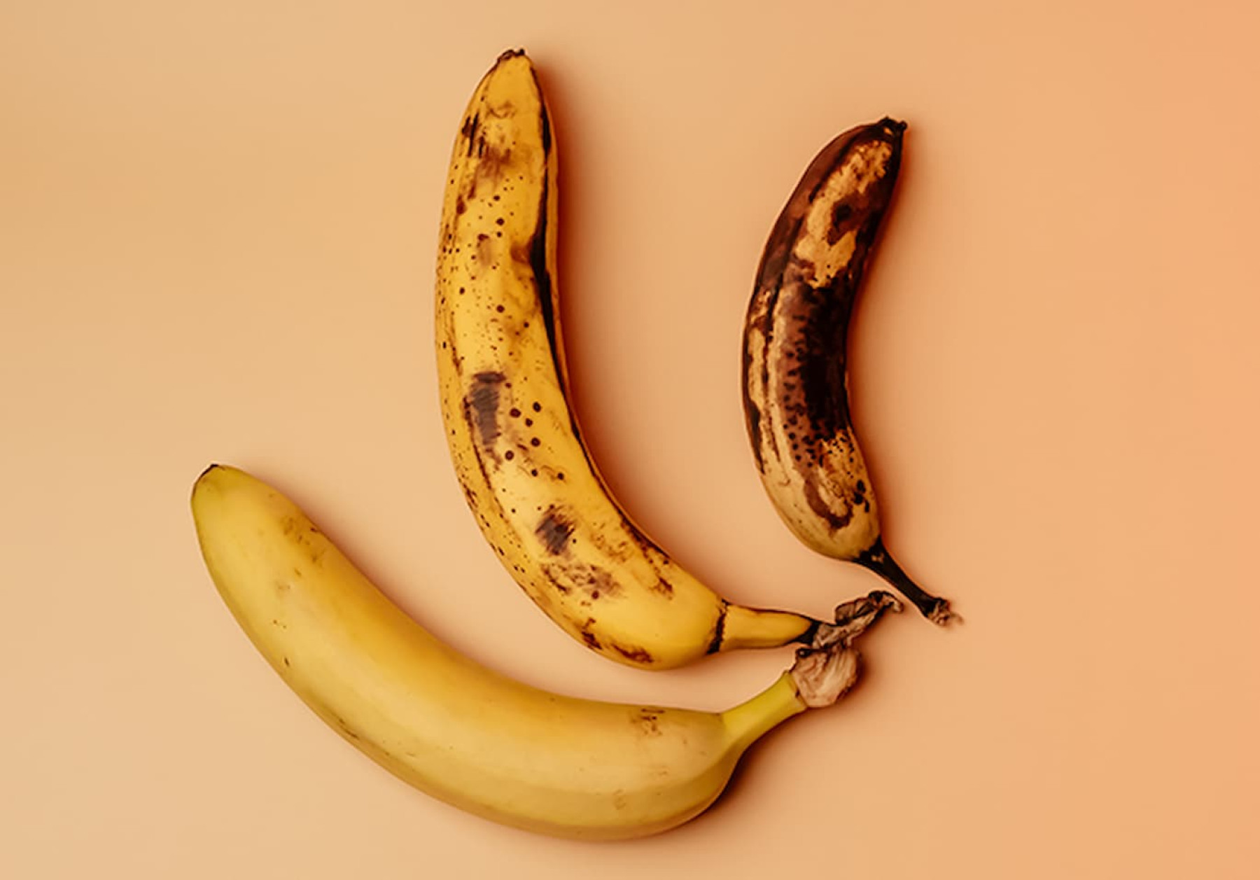 penile melanotic macule causes macules of the penis] Penile Melanosis Signs and Symptoms